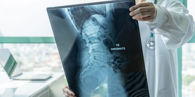 spine 1 scaled